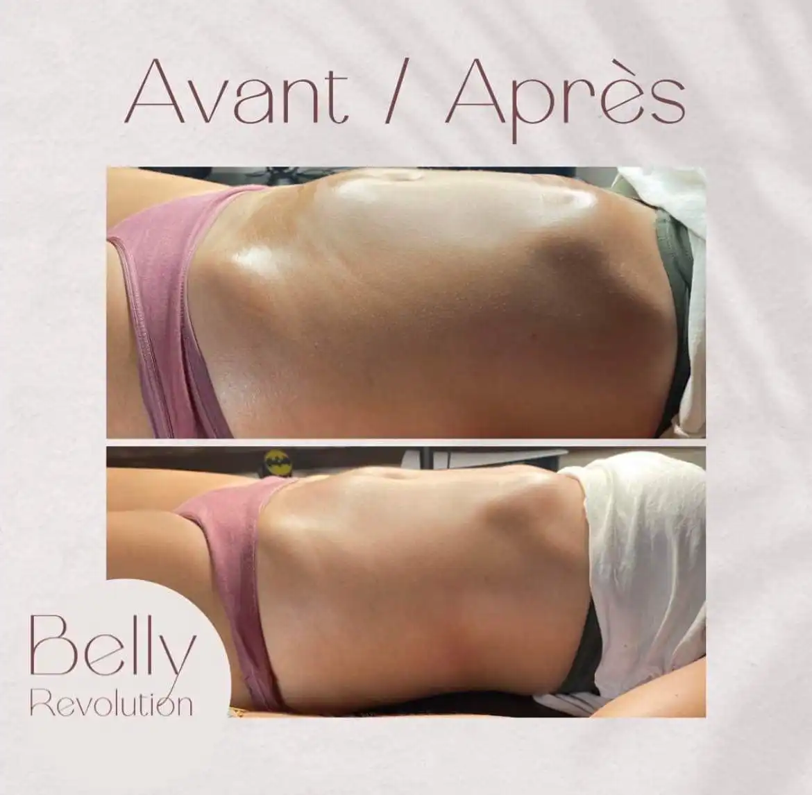 belly revolution optim